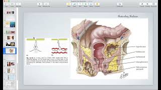 Surgical Site Infection Part 2  General Surgery Course 3rd Stage [upl. by Florrie]