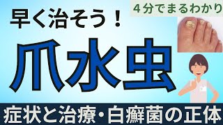 早く治そう！爪水虫の症状と治療法、白癬菌の実態まで！４分でまるわかり♪ [upl. by Naenaj]