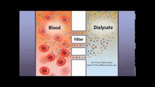 Hemodialysis Hemofilter and countercurrent animation [upl. by Anyel]