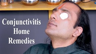 Conjunctivitis Treatment  How To Cure Conjunctivitis  Home Remedies For Conjunctivitis [upl. by Nani]