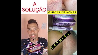 Cicatricure Gel para Estrias e Cicatrizes  Solução baratinha [upl. by Cristin168]