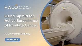 The Value of Multiparametric MRI in Active Surveillance of Prostate Cancer [upl. by Nollahs]