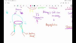 valvular heart disease mitral part 1 [upl. by Enisamoht]