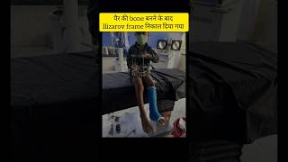 Ilizarov से बचा 6 वर्ष के अरसलाम का पैर fracture boneinfection ilizarov osteomyelitis ytshorts [upl. by Dorri738]