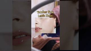 skinbooster skinboosters injeksi treatmentwajah facetreatment facecare treatments pretty [upl. by Ellan]