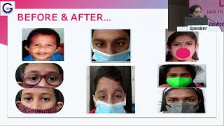 AIOC2022GP146Dr Neena R PAPER FP440  ACUTE ACQUIRED COMITANT ESOTROPIA PRECIPITATED BY [upl. by Gorlicki]