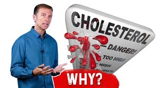 Why Do You Get High Cholesterol After Intermittent Fasting – DrBerg [upl. by Bilow]