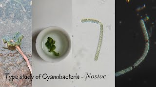 Type Study of Cyanobacteria  Nostoc [upl. by Kessler]