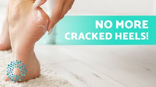 How to REMOVE FOOT DRYNESS 🦶🏽 Cause Treatments and Home Remedies [upl. by Salahcin]