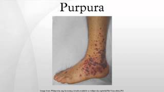 Purpura [upl. by Lad]