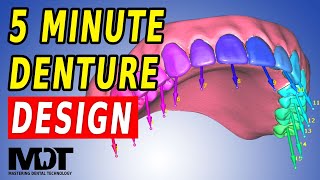 The Fastest Copy Denture Result  Exocad 32 Elefsina Design Tutorial [upl. by Heymann]