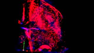 3D reconstruction Twophoton microscopy of DsRed mouse lymph node [upl. by Namsu]