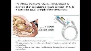 Fetal Monitoring Interventions [upl. by Emilia]