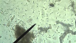 Protists Amoeba Euglena Paramecium [upl. by Refenej]