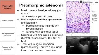 Salivary Gland Neoplasms [upl. by Hindu]