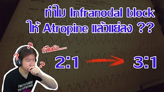 ทำไม Infranodal AV block ให้ Atropine แล้วแย่ลง   Frontline EKG [upl. by Hessney758]