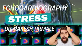 Stress Test  Dobutamine Stress Echocardiogram  DR Rakesh Tirmale Galaxy Hospital mulund [upl. by Erdnassac]