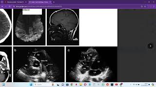 RADIOLOGY EXAM CASES [upl. by Ammej60]