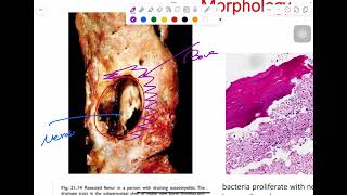 MSS pathology lab 2  part 1 [upl. by Lenoyl]