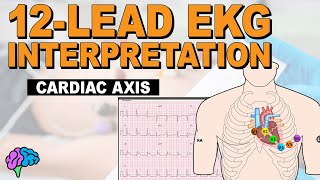 Understanding Cardiac Axis and Deviations  12Lead EKG [upl. by Laehcym748]