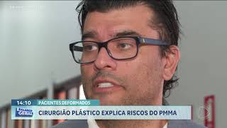 PACIENTES DEFORMADOS CIRURGIÃO PLÁSTICO EXPLICA RISCOS DO PMMA [upl. by Hulbig]