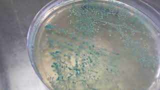 Candida albican on candida deferential agar plate  Budding yeast [upl. by Guinna262]