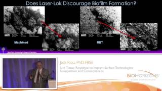 Does LaserLok discourage biofilm formation [upl. by Ardnuasac]