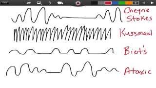 Irregular Breathing Patterns  EMTprepcom [upl. by Airotkciv]