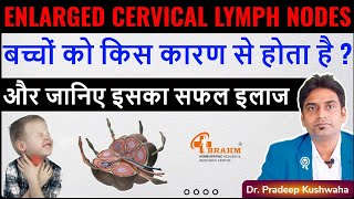 Enlarged cervical lymph nodes treatment  Cervical lymph nodes in child  lymphadenitis [upl. by Namyac839]