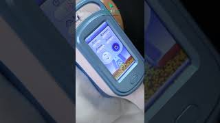 Labelles Advanced Cryolipolysis Treatment [upl. by Worlock]