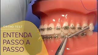 Instalação do Propulsor Mandibular GoToOne da Leone APM [upl. by Aleacim]