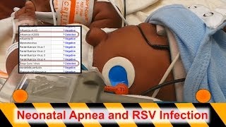 Neonatal Apnea and RSV Infection [upl. by Anneuq]