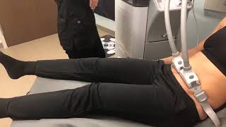 SculpSure Live Demo [upl. by Raymund]