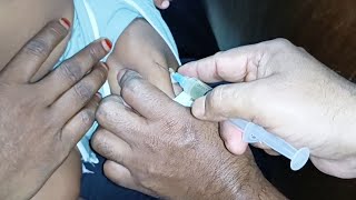 Ceftriaxone 500mg Ceftrone  amp Dexamethasone intramuscular injection Video 24 Ep 85 Injection Tips [upl. by Marjana]