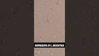 Trophozoite of Entamoeba histolytica [upl. by Sophy]