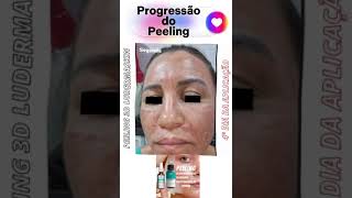 Peeling 3d da LUDERMASKIN [upl. by Yaf670]