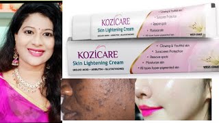 KOZICARE skin lightening cream review in Telugu [upl. by Va685]