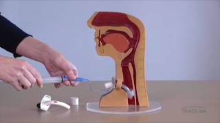 Tracheostomy  Respiratory phonatory and swallowing function  TRACS WA [upl. by Marentic]