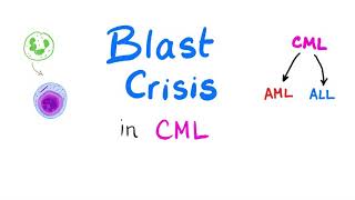 Blast Crisis in Chronic Myeloid Leukemia CML  When Chronic Myeloid Leukemia Goes Mad Hematology [upl. by Mitman]