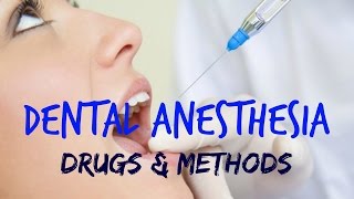 Dental Anesthesia [upl. by Ruphina]