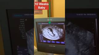 10 Week Baby 😱😱  USG  Bsc Nursing Students life youtubeshorts trendingshorts ytshorts shorts [upl. by East]