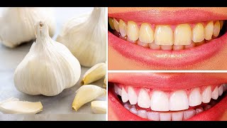 Teeth whitening at home with simple things  teeth whitening at home garlic salt and tooth past [upl. by Lauer]