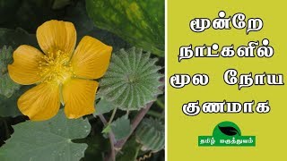 மூன்றே நாட்களில் மூல நோய் குணமாக  Thuthi ilai uses in Tamil  Abutilon Indicum for Piles [upl. by Eirene]