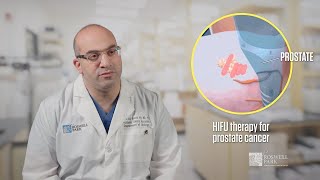 HIFU Treatment for Prostate Cancer  Dr Ahmed Aly Hussein [upl. by Eninnaej]