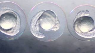 Zebrafish Embryos [upl. by Dylane856]