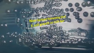 Nonlactose fermenting Escherichia coli growth on CLED Agar [upl. by Perot]