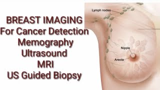 BREST Cancer imaging Memography Ultrasound MRI Radionuclide Imaging and breast biopsy [upl. by Sonafets]