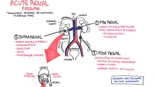 Acute Renal Failure [upl. by Tahpos]