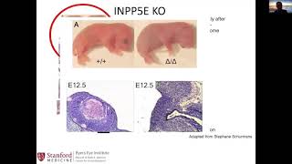 Joubert syndrome and ciliopathy relationship to ODD and optic neuropathies [upl. by Rafe]