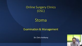 OSC  Stoma Examination and Management [upl. by Dylan429]